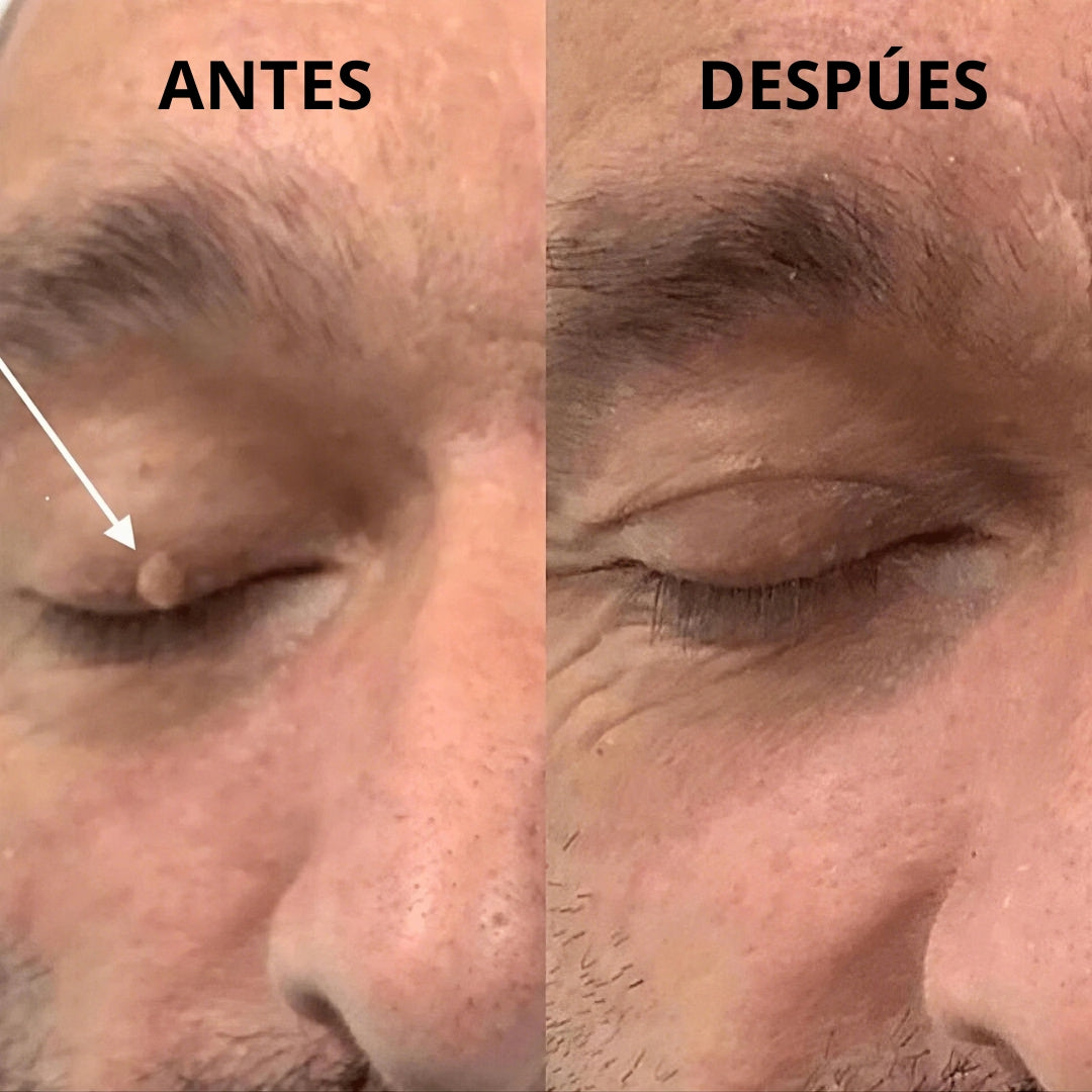 Dermazen tm