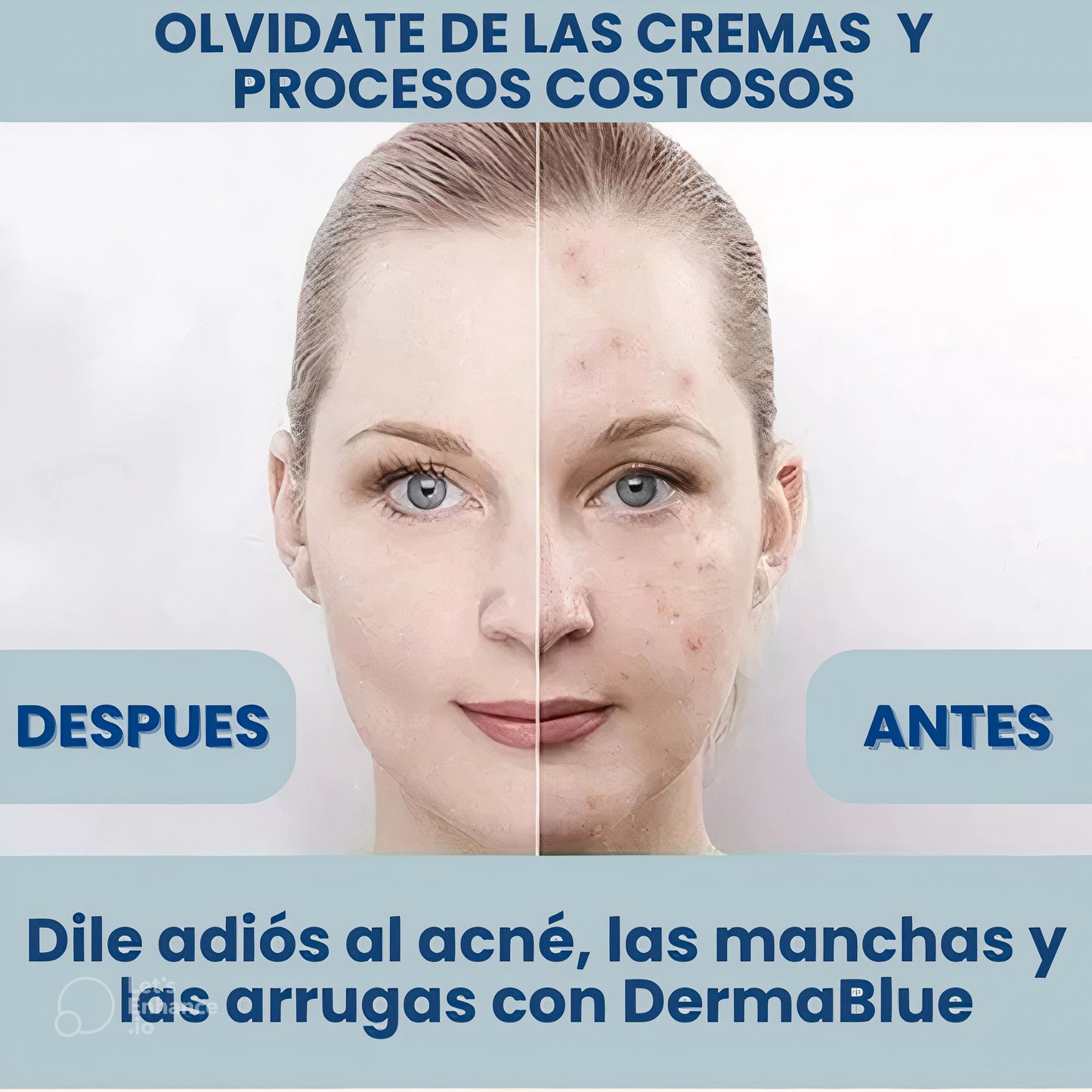 Lapíz laser facial DermaBlue™️elimina acne, manchas por el sol, y arrugas en la piel