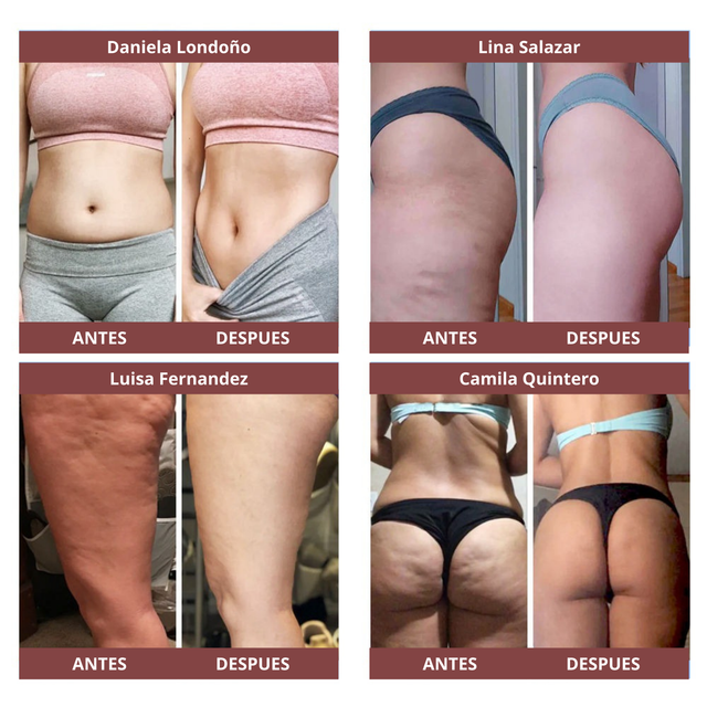 MASAJEADOR CELLUGLOW ™️ELIMINA CELULITIS EN 30 DÍAS + EBOOK GRATIS SOLO POR HOY🔥