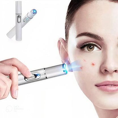 Lapíz laser facial DermaBlue™️elimina acne, manchas por el sol, y arrugas en la piel