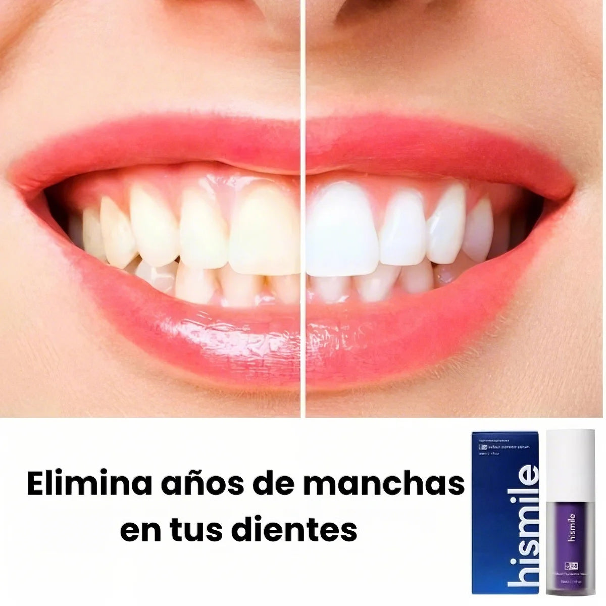 HISMILE™️– BLANQUEA TUS DIENTES Y ELIMINA MANCHAS AMARILLAS DESDE EL PRIMER USO + ENVIO GRATIS + EBOOK DE REGALO🎁 40% DE DESCUENTO