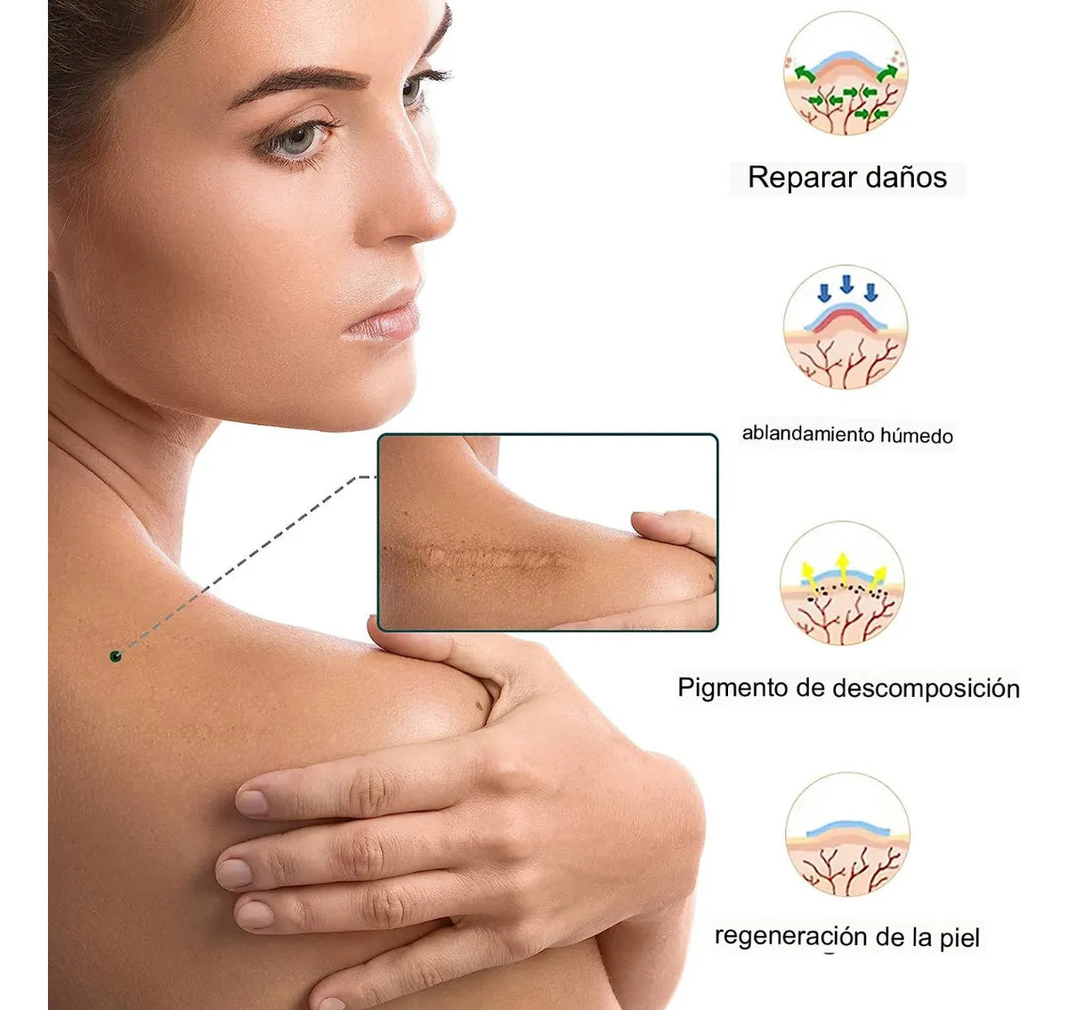 SILICONSKIN™️ELIMINA CICATRICES Y ARRUGAS + EBOOK DE REGALO 🎁 + ENVÍO GRATIS