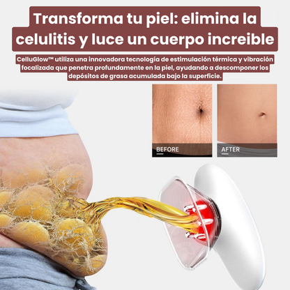MASAJEADOR CELLUGLOW ™️ELIMINA CELULITIS EN 30 DÍAS + EBOOK GRATIS SOLO POR HOY🔥