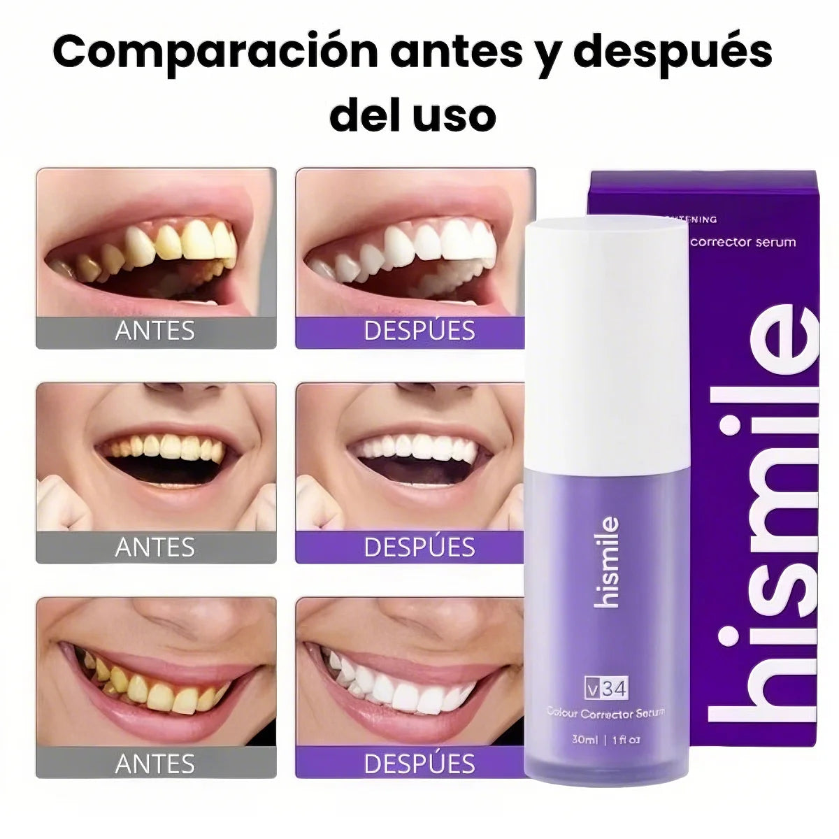 HISMILE™️– BLANQUEA TUS DIENTES Y ELIMINA MANCHAS AMARILLAS DESDE EL PRIMER USO + ENVIO GRATIS + EBOOK DE REGALO🎁 40% DE DESCUENTO