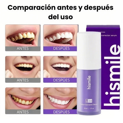 HISMILE™️– BLANQUEA TUS DIENTES Y ELIMINA MANCHAS AMARILLAS DESDE EL PRIMER USO + ENVIO GRATIS + EBOOK DE REGALO🎁 40% DE DESCUENTO