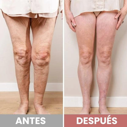 NEUROFLEX™ – ALIVIO RÁPIDO PARA EL DOLOR DE PIERNAS Y PIES + EBOOK DE REGALO 🎁 + ENVÍO GRATIS - 50% DE DESCUENTO