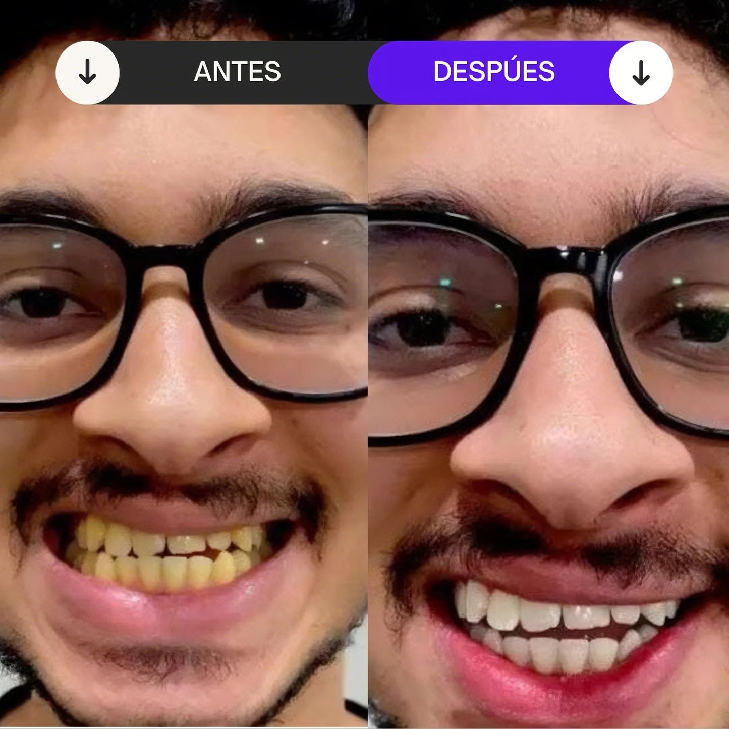 HISMILE™️– BLANQUEA TUS DIENTES Y ELIMINA MANCHAS AMARILLAS DESDE EL PRIMER USO + ENVIO GRATIS + EBOOK DE REGALO🎁 40% DE DESCUENTO