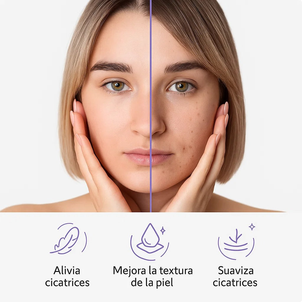SILICONSKIN™️ELIMINA CICATRICES Y ARRUGAS + EBOOK DE REGALO 🎁 + ENVÍO GRATIS