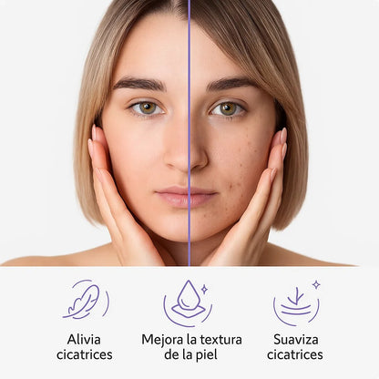 SILICONSKIN™️ELIMINA CICATRICES Y ARRUGAS + EBOOK DE REGALO 🎁 + ENVÍO GRATIS