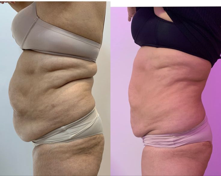 MASAJEADOR CELLUGLOW ™️ELIMINA CELULITIS EN 30 DÍAS + EBOOK GRATIS SOLO POR HOY🔥