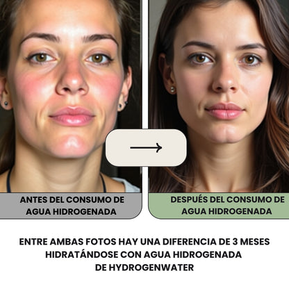 TERMO GENERADOR DE AGUA HIDROGENADA HIDROWATER™️REGENERA TU CUERPO, ANTIENVEJECIMIENTO Y AUMENTA TU ENERGÍA + EBOOK GRATIS